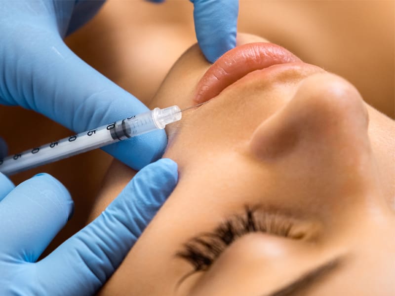 LM-dermal-fillers-permanent Patient receiving injection of dermal fillers in the lip area